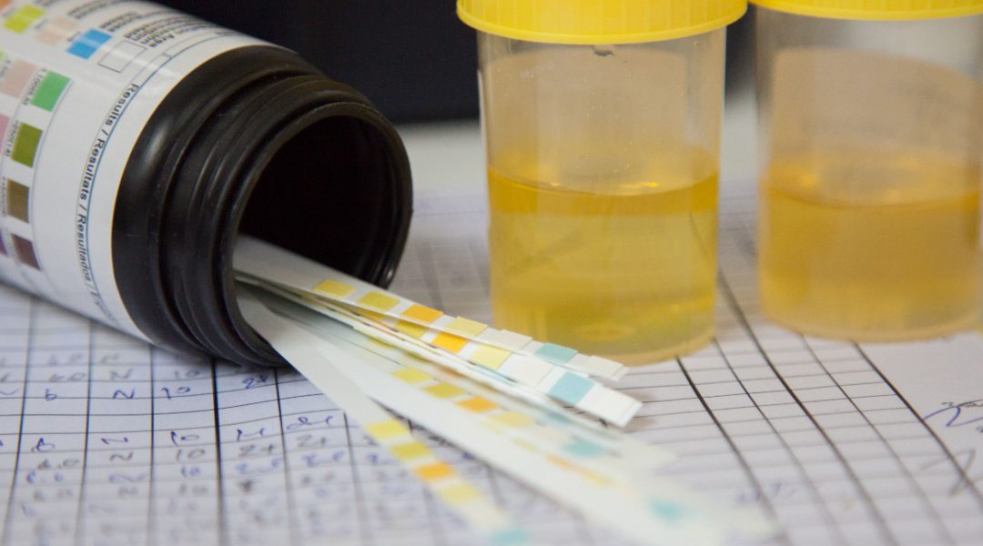Detox za THC test – kako delujejo detox napitki